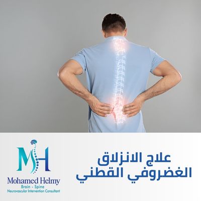 علاج الانزلاق الغضروفي القطني
